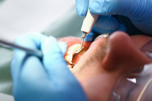 Best Emergency Gum Treatment in Russellville, AL