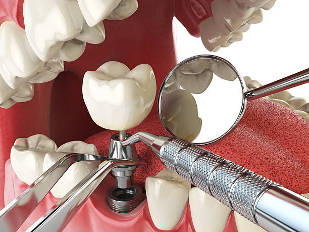 Best Weekend Emergency Dentist in Russellville, AL