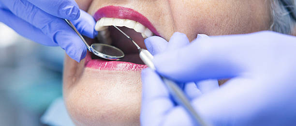 Best Emergency Tooth Extraction in Russellville, AL